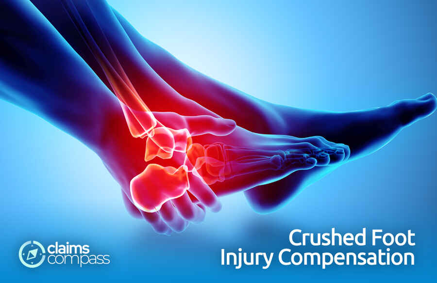 Crushed Foot Injury Compensation Key Points On Claiming